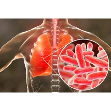 Prevence legionelly v domácnosti